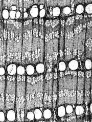 環孔材の顕微鏡写真 ハリギリ